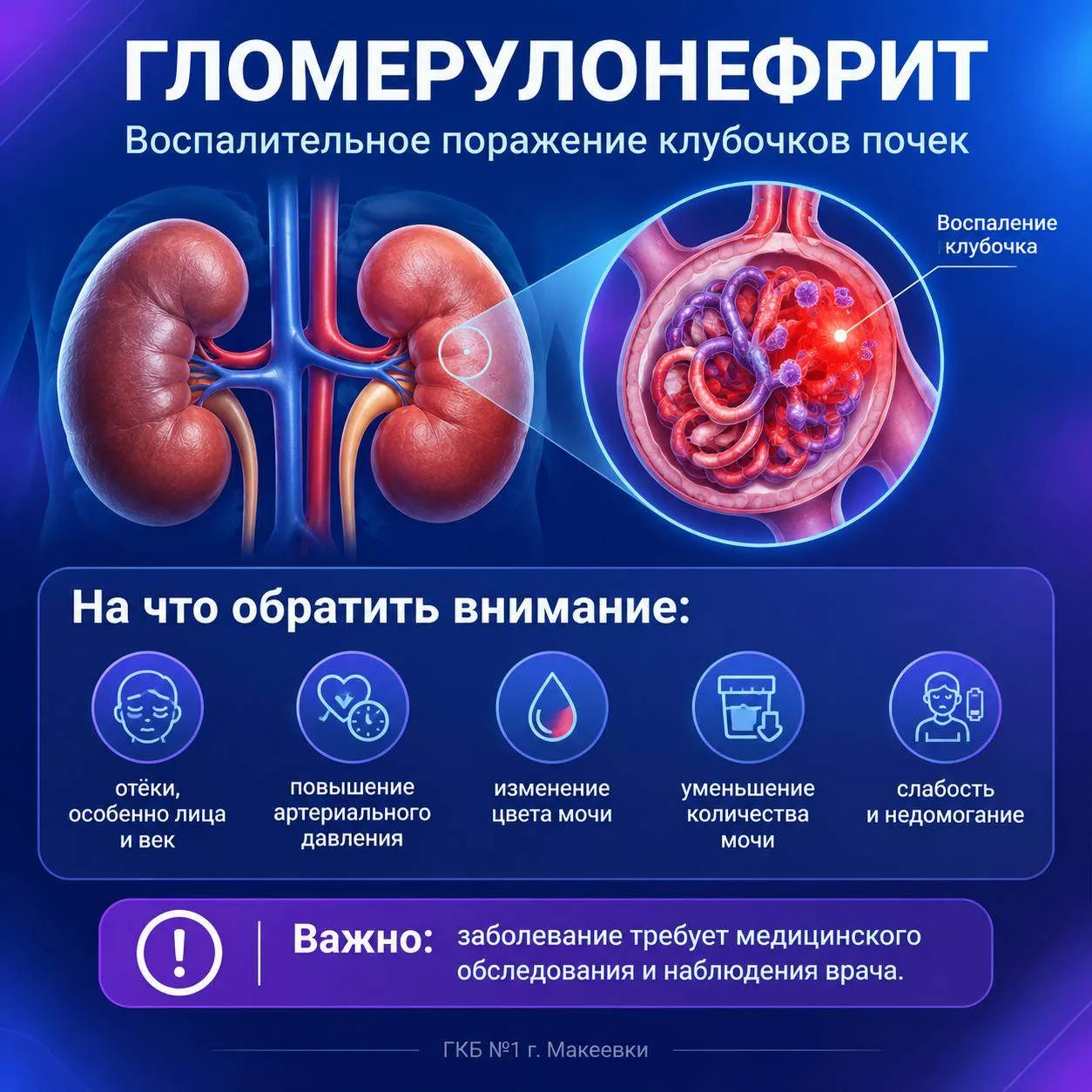 Гломерулонефрит: что это и как его распознать?