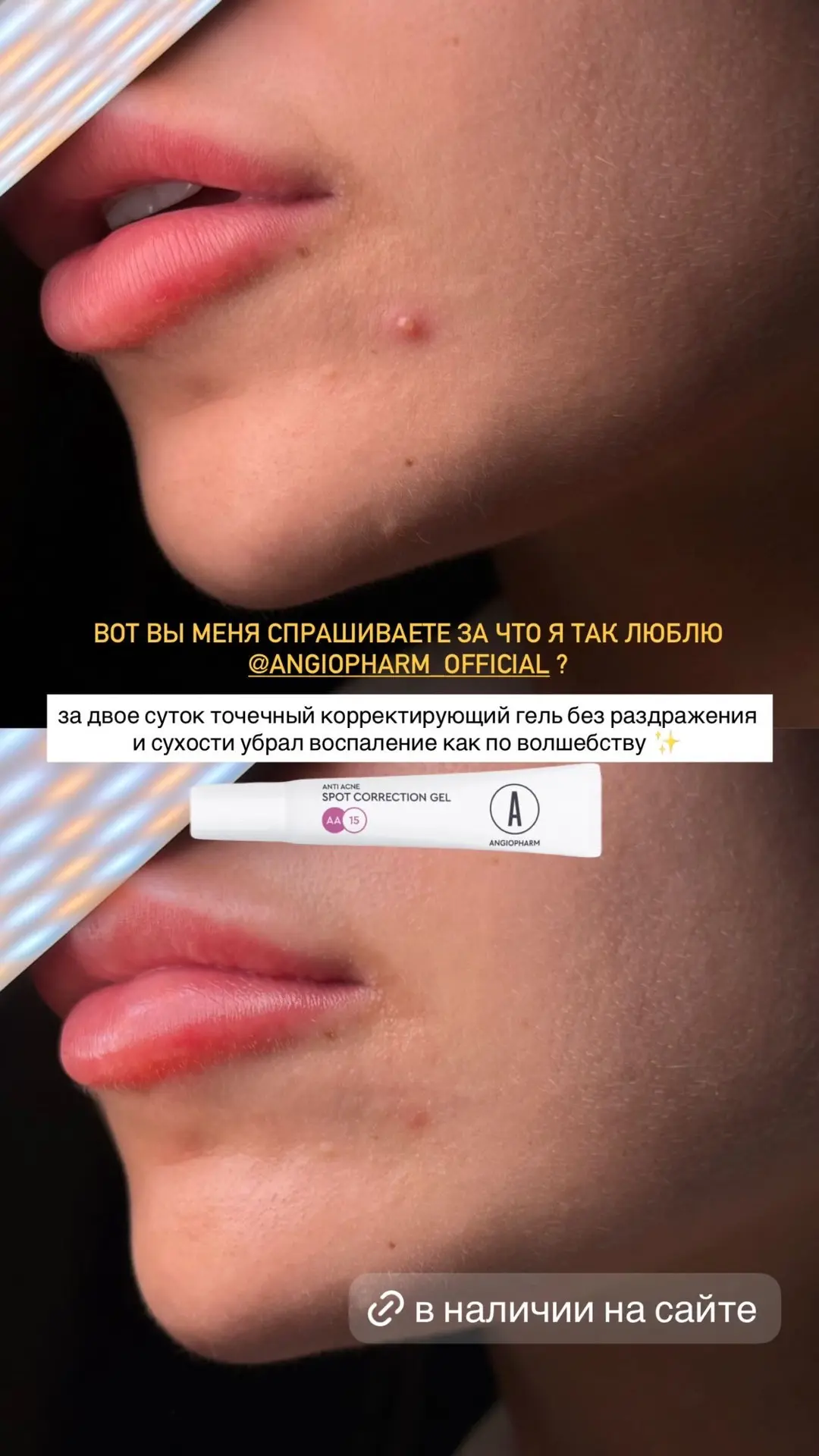 Ваш sos-помощник в косметичке 😍