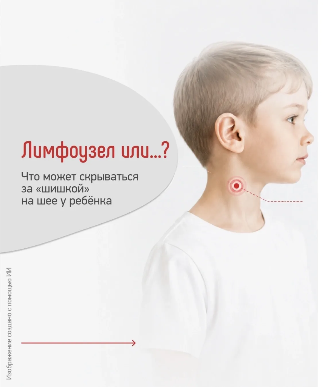 «Шишка» на шее у ребёнка — находка, которая почти всегда заставляет родителей насторожи...