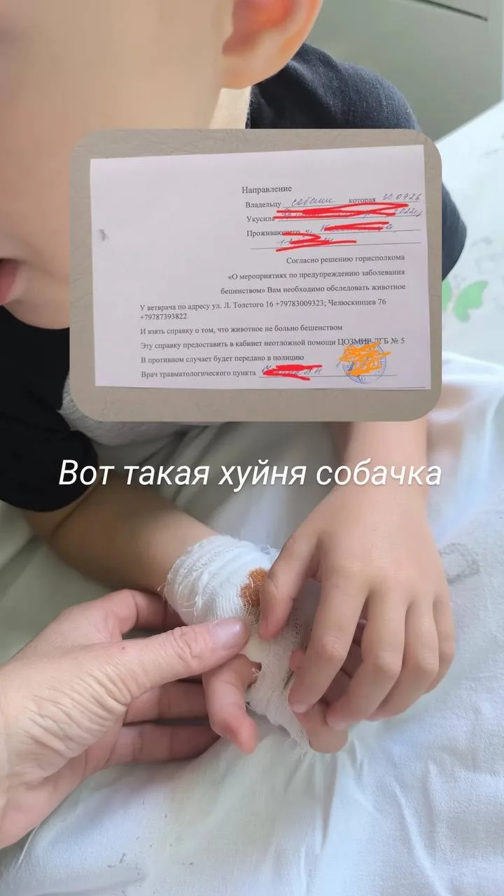 ❗️Джек-рассел укусил трёхлетнего малыша на детской площадке в Севастополе.