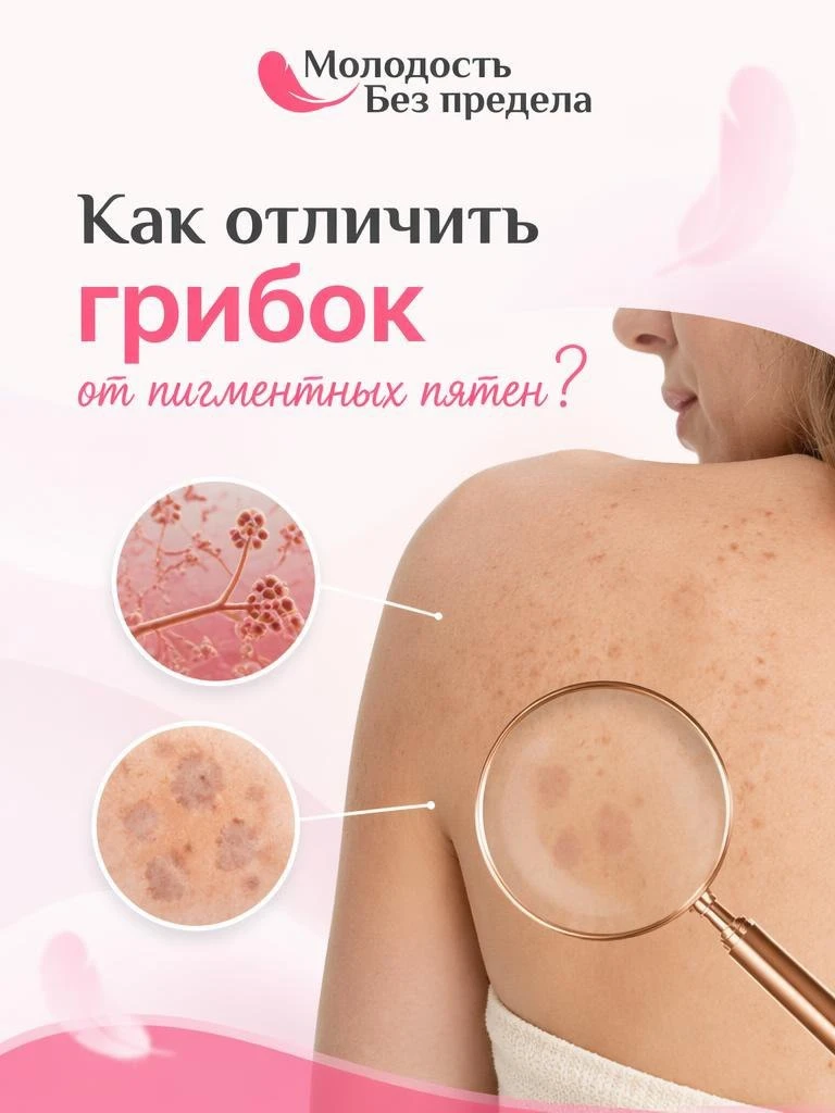 Как отличить грибок от пигментных пятен? 

Вы достаёте платье с открытой спиной.

Смотрите в зеркало