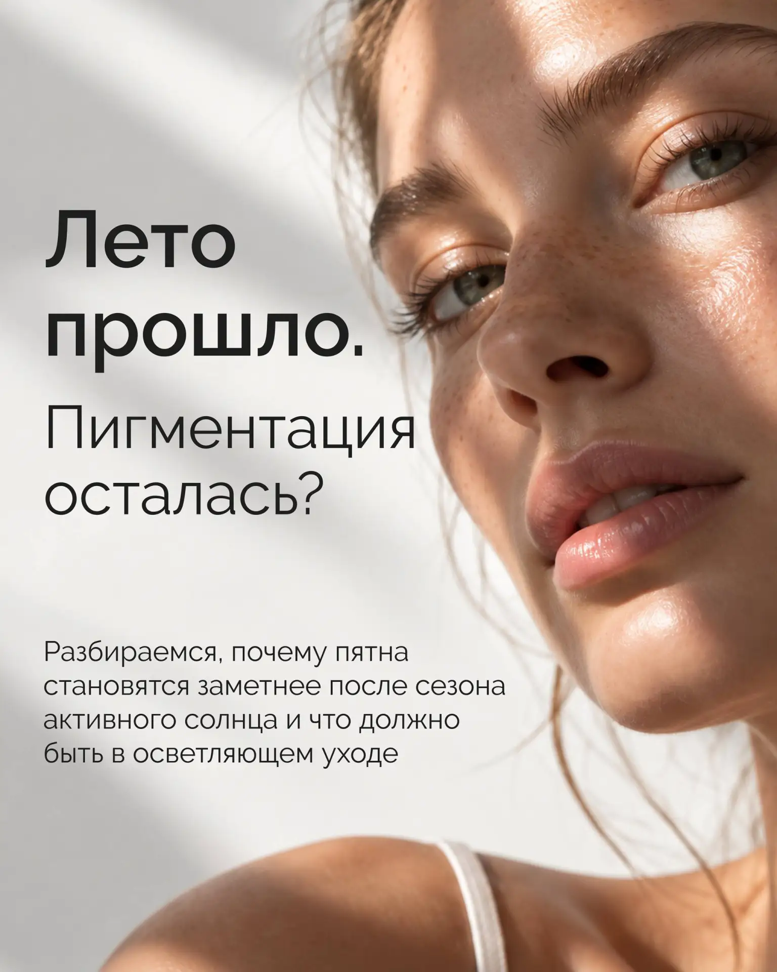 Пигментация после лета: что добавить в уход сейчас