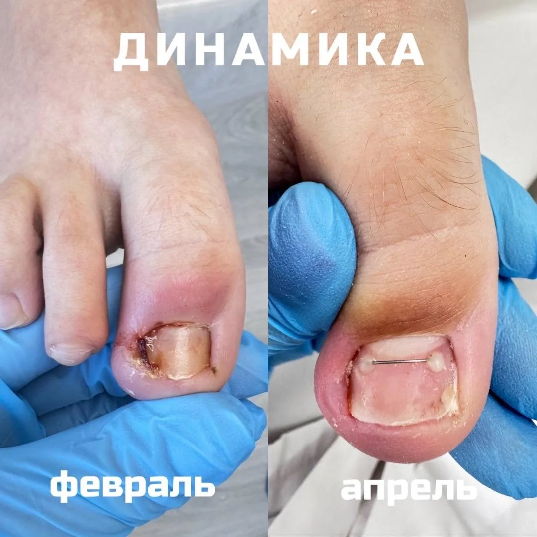 Делимся очередной динамикой💪🏻