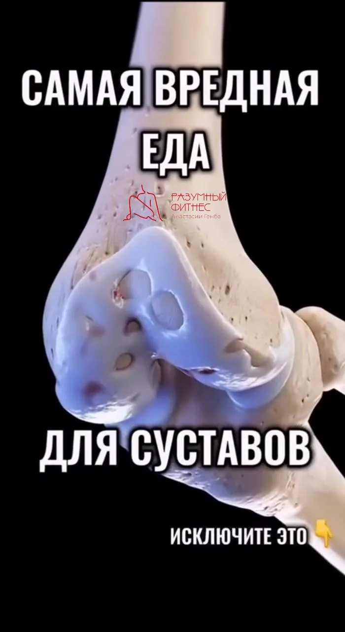📣 Хрустят колени, есть воспаления или артроз?