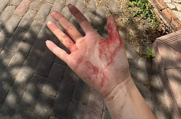 Овчарка напала на участницу шоу «Уральские пельмени» Илану Дылдину и её питомца