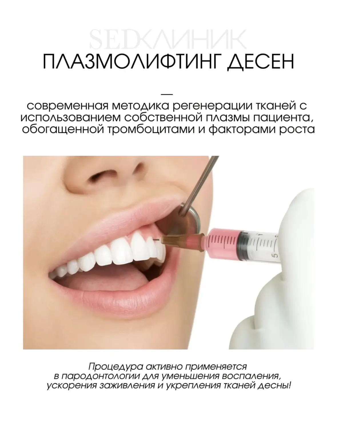 ПЛАЗМОЛИФТИНГ ДЕСЕН