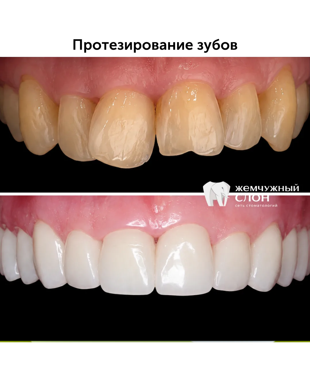 Большая работа команды филиала на Масленникова, 39. В первую очередь - санация полости ...