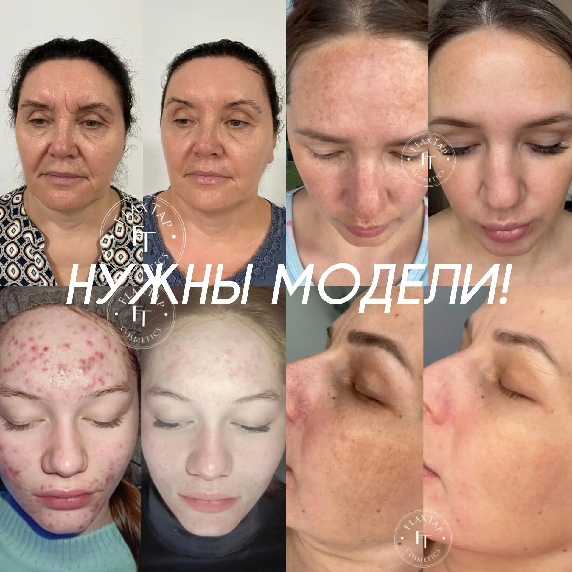 Напоминаю, друзья мои ❤️ Чемпионат не за горами 👌 Я ещё набираю моделей! Приглашаю жен...