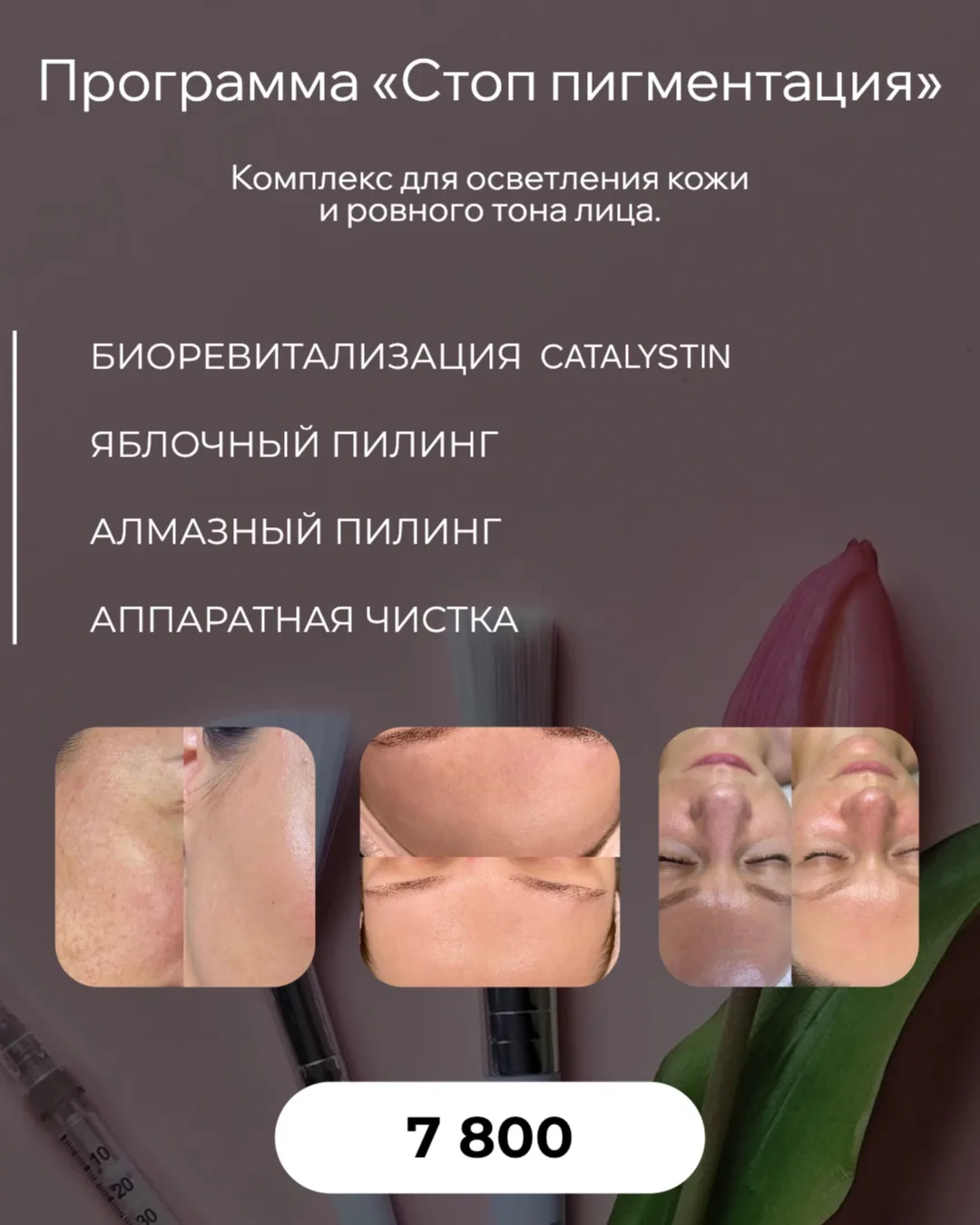 🌸 Программа «Стоп пигментация»