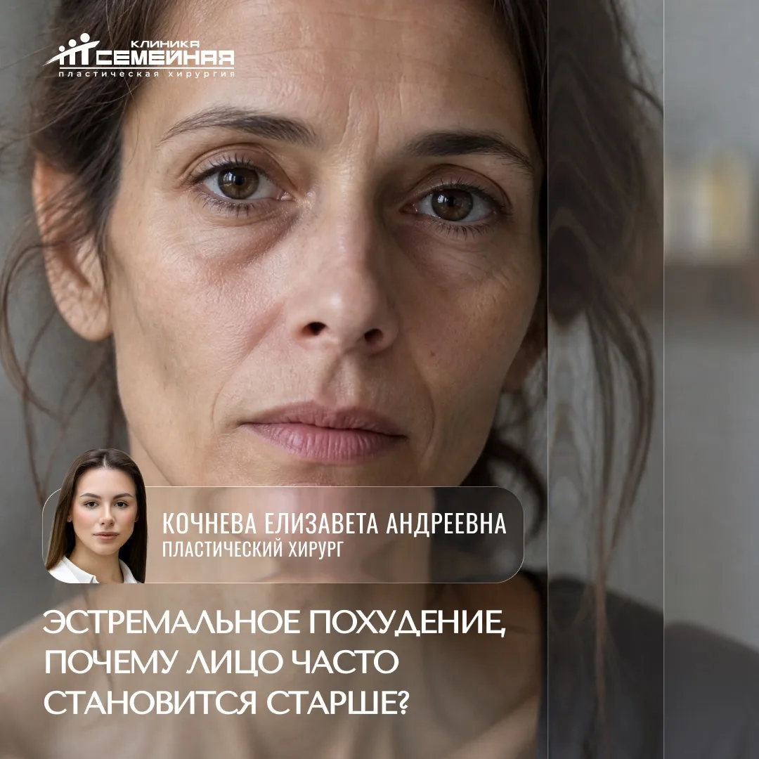 Почему экстремальное похудение заставляет лицо выглядеть старше?