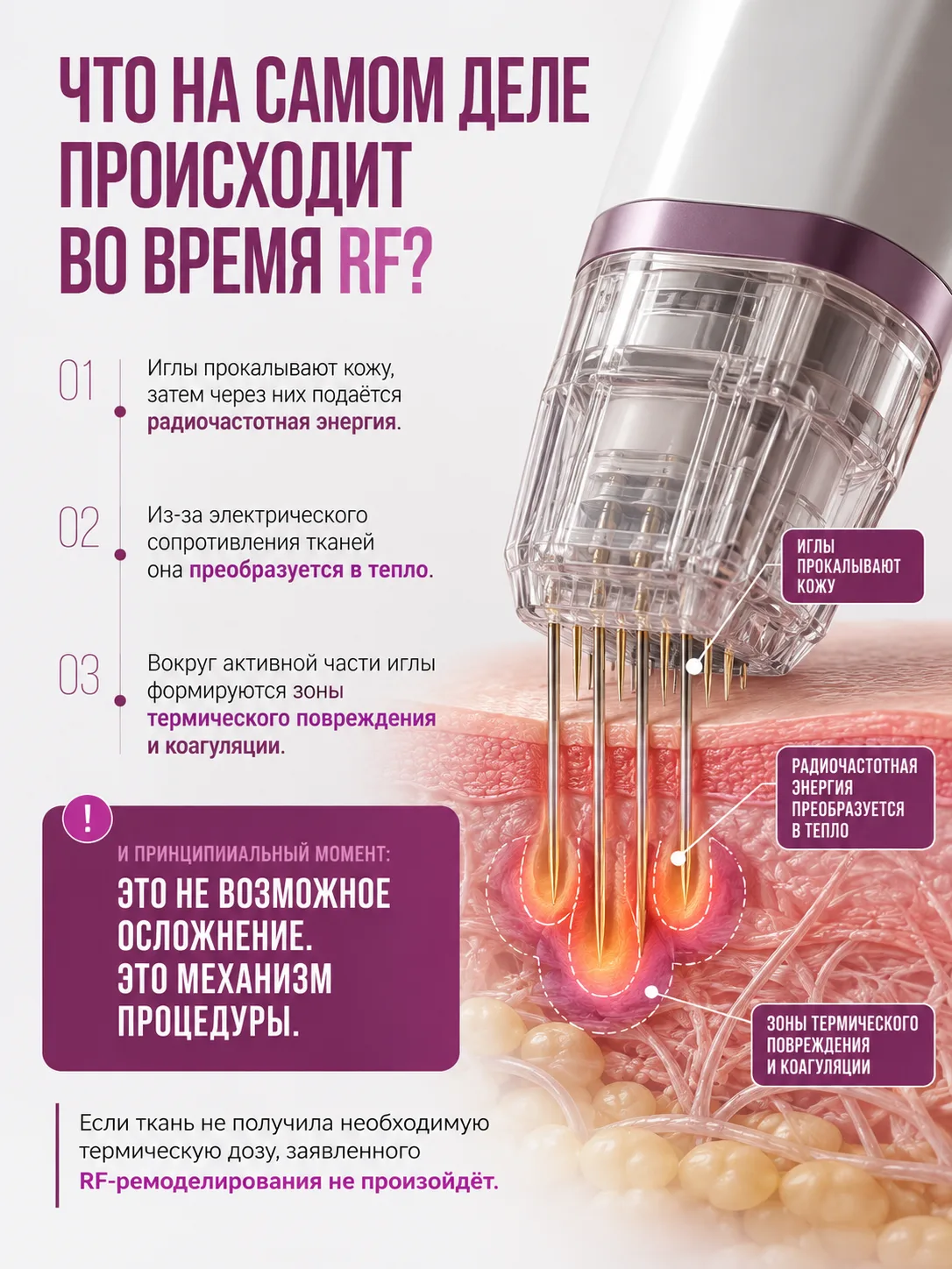 Почему я не делаю RF-лифтинг ни себе, ни своим клиентам