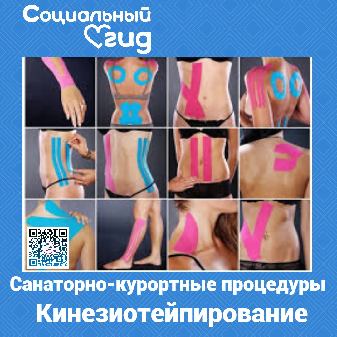 Кинезиотейпирование — это метод физиотерапевтического воздействия, при котором на кожу накладывают с