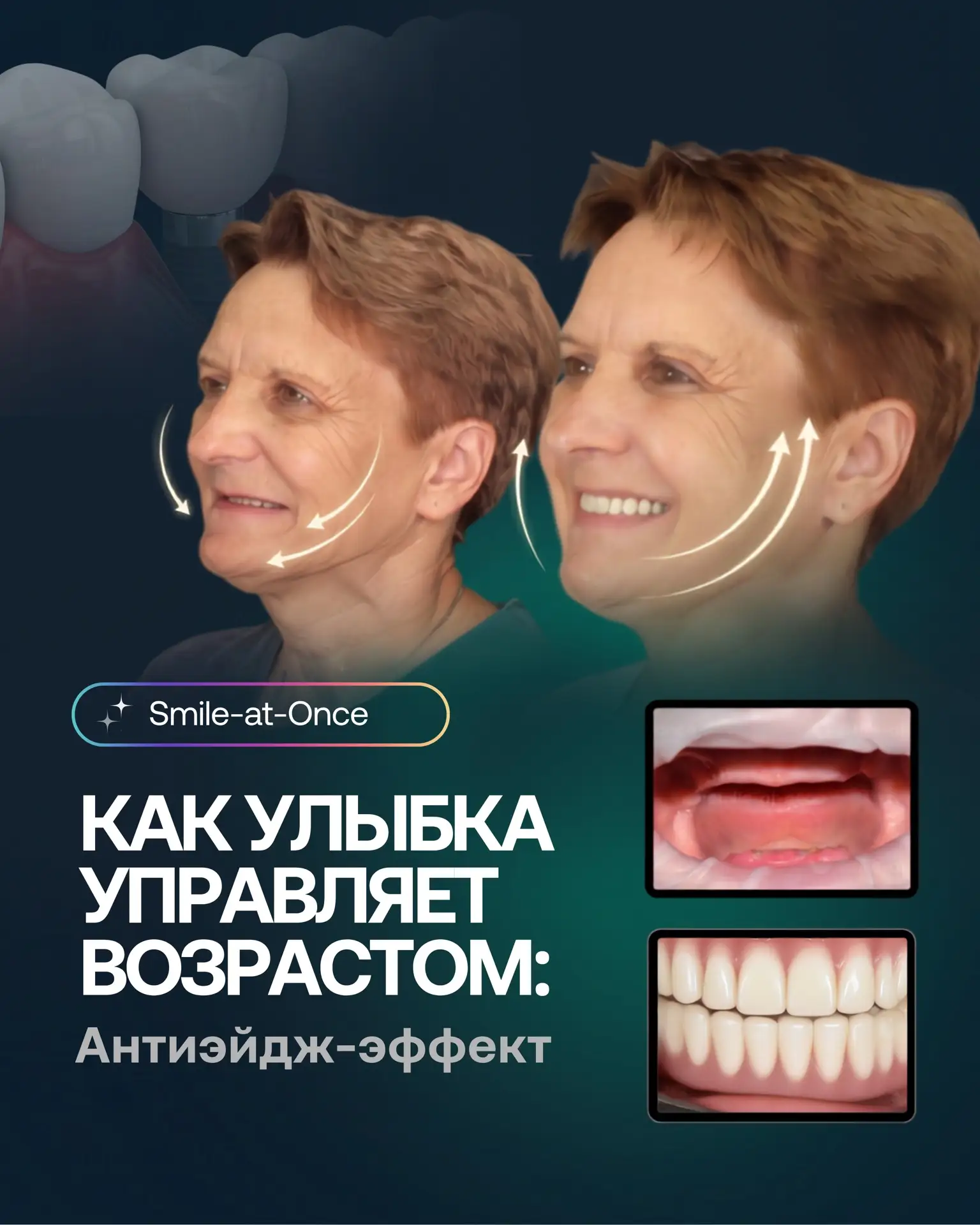 Возраст читается по улыбке — и вот почему ⬇️

Когда хочется выглядеть свежее и моложе, мы обычно дум