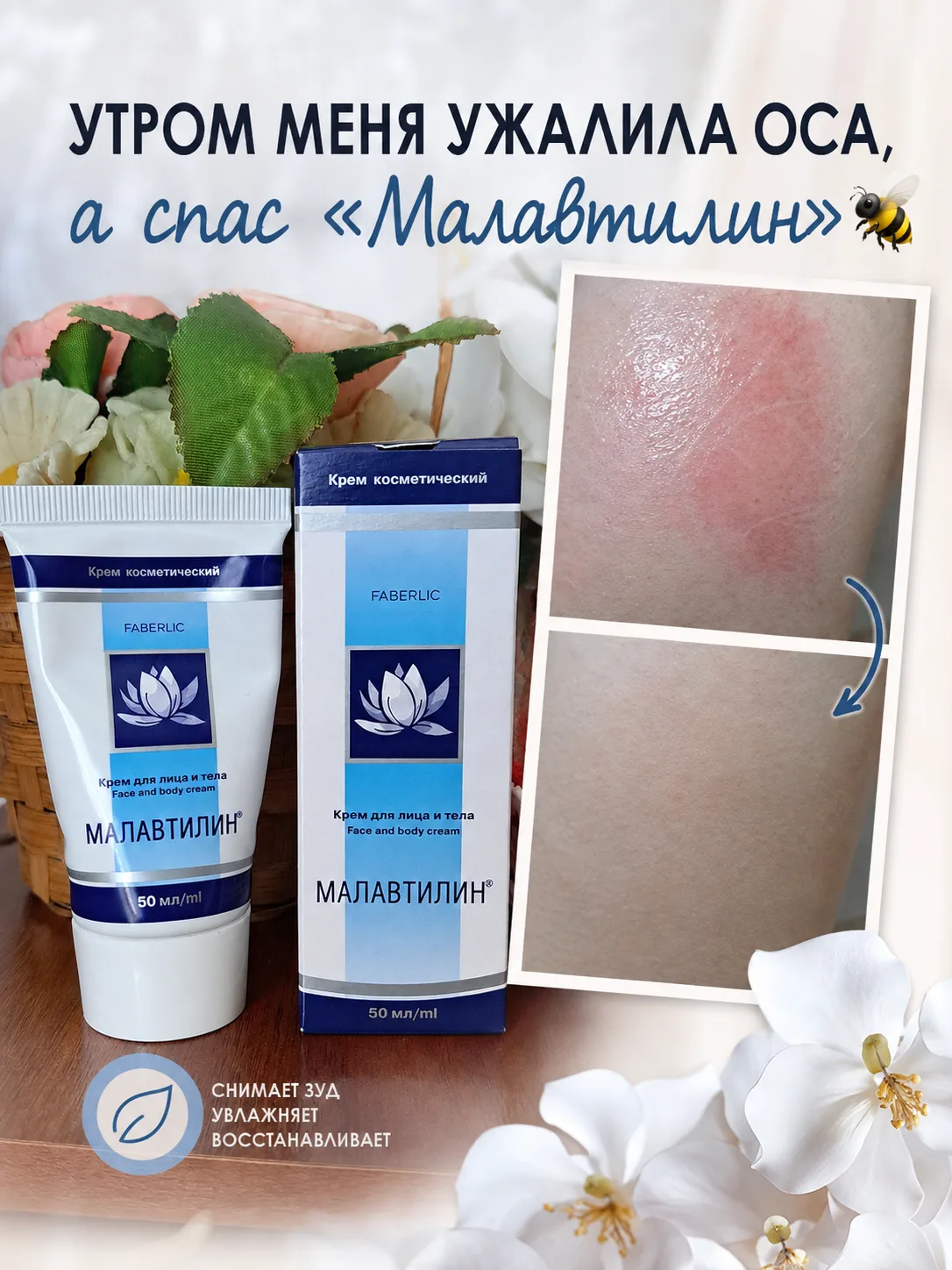 Утром меня ужалила оса, а спас «Малавтилин» 🐝