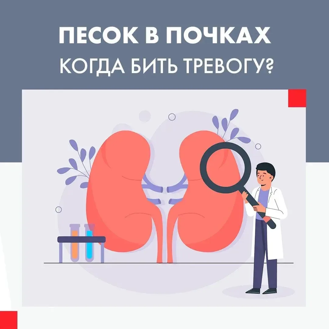Песок в почках: когда пора бить тревогу?

Легкий дискомфорт в пояснице? Изменился цвет мочи? Обычно 