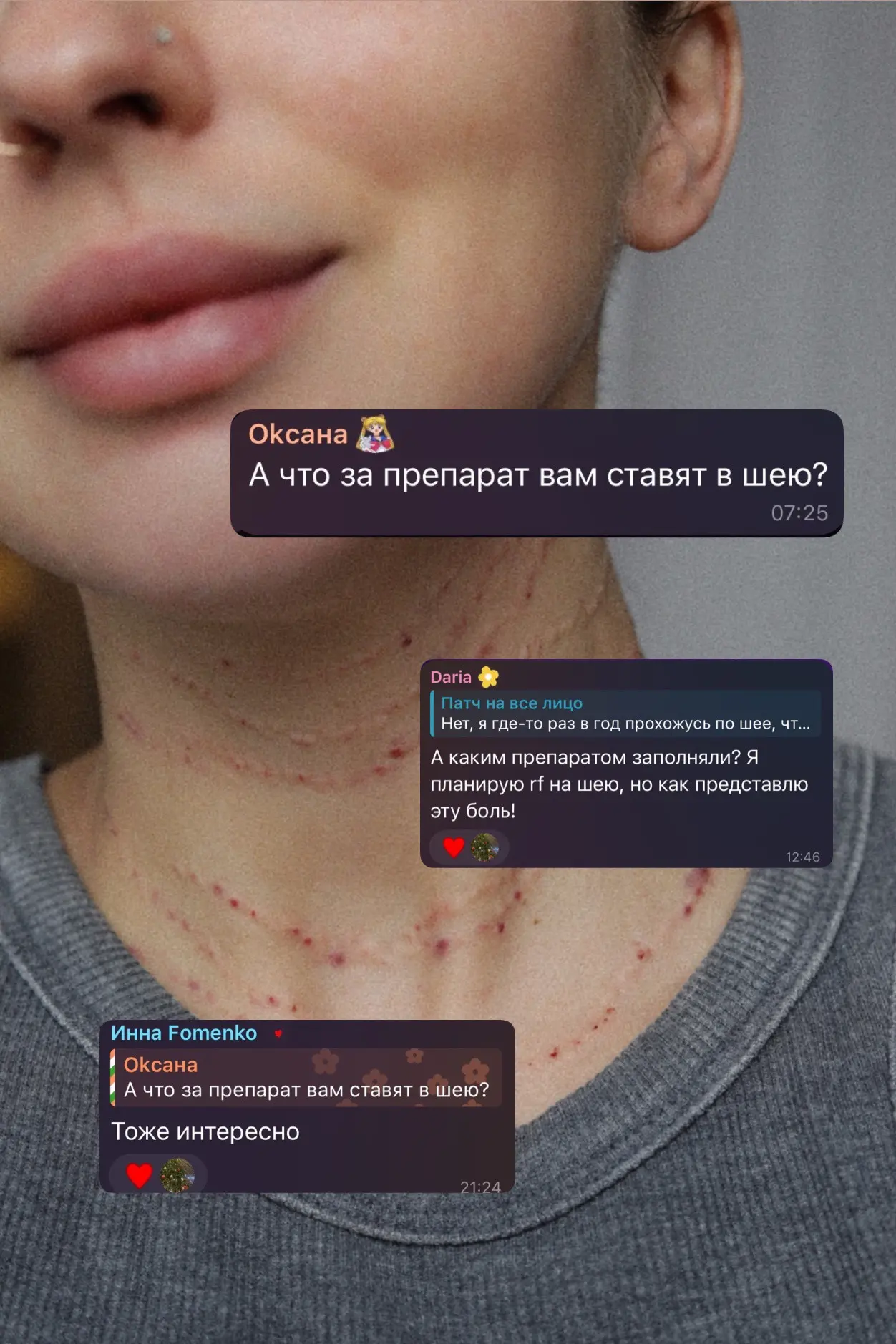 Кстати, что касается шеи…месяц назад мы уже проходились по ней, но тогда мы заполняли з...