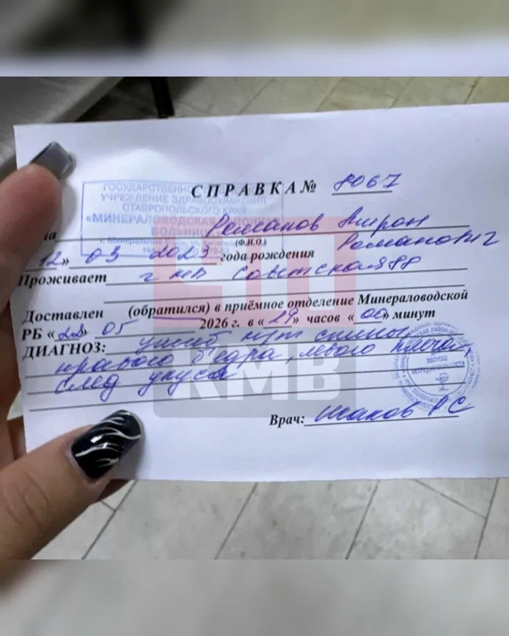 ❗️В Минераловодском округе расследуются появление укусов у ребенка. — пишет губернатор Владимиров.  