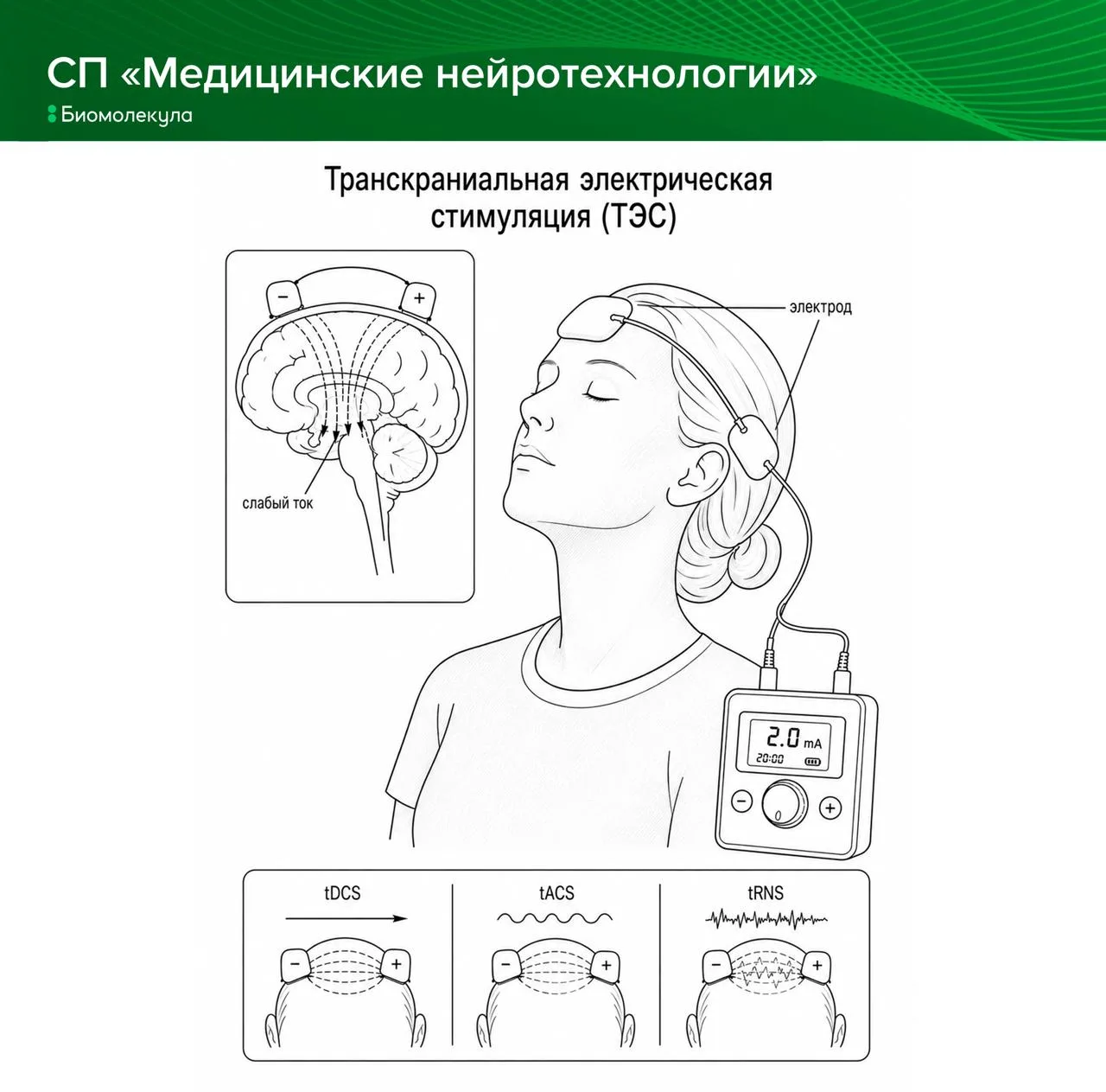 Транскраниальная электрическая стимуляция (tES) работает совсем не так, как ТМС. Вместо...
