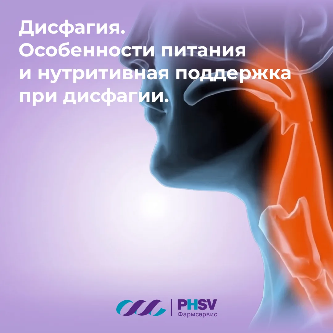 Дисфагия. Особенности питания и нутритивная поддержка при дисфагии.