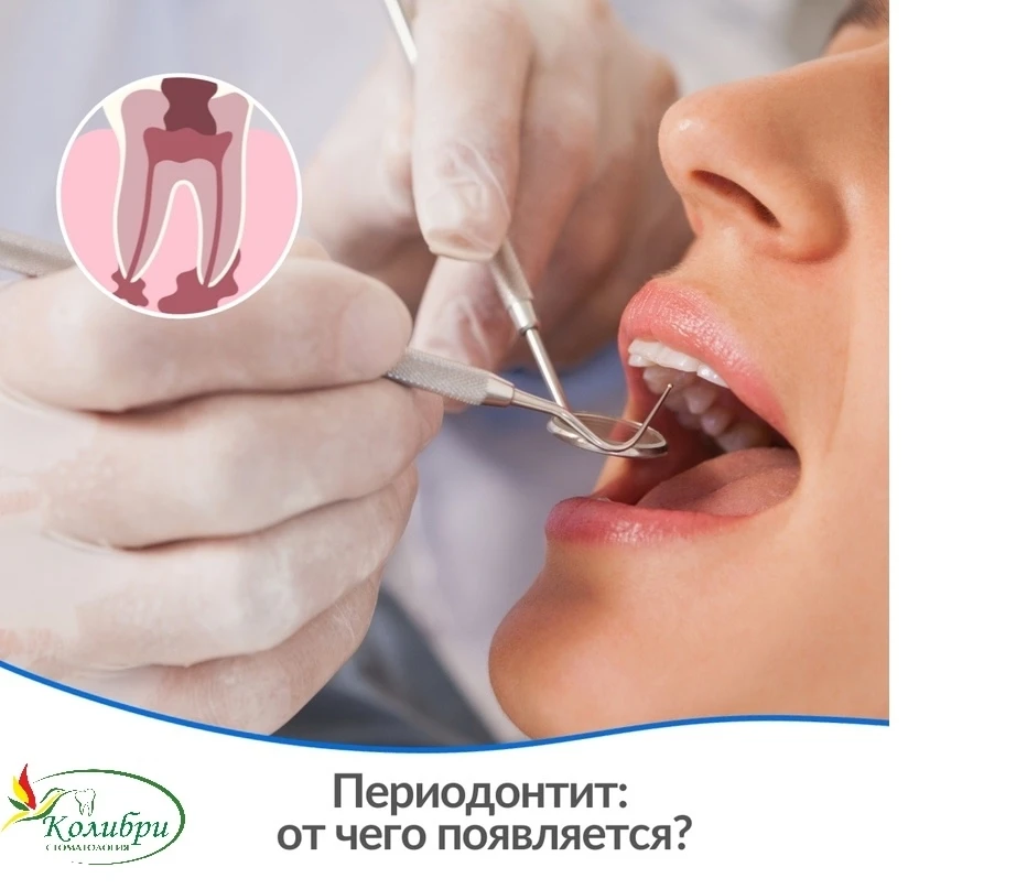 Друзья, сегодня мы хотим поговорить об одном из распространенных заболеваний, которое м...