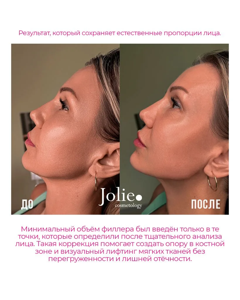 Изображение 4 к публикации «Центр косметологии Jolie»