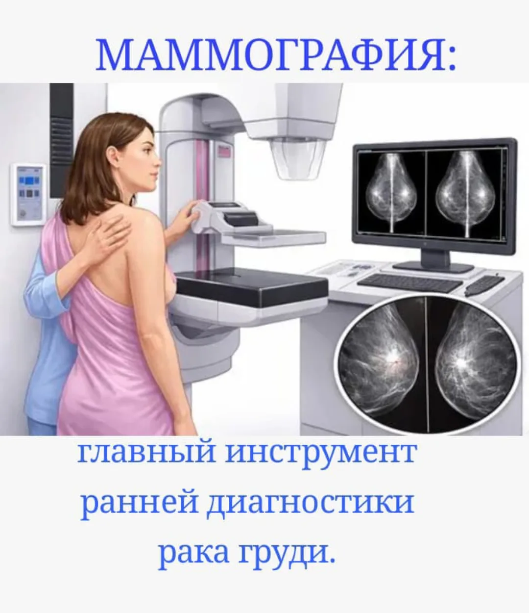 Маммография: главный инструмент ранней диагностики рака груди.