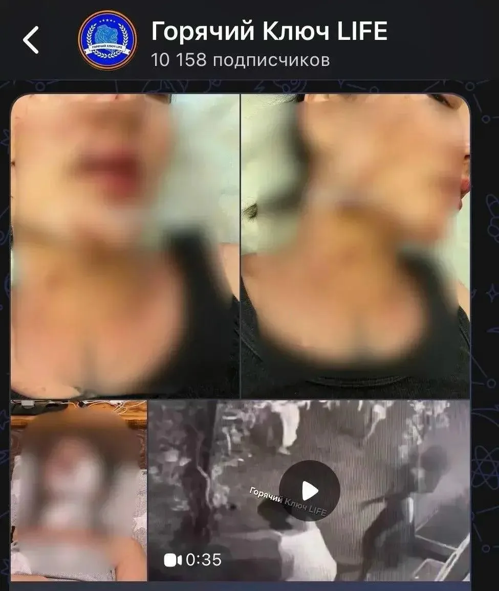 Возбуждено уголовное дело после конфликта возле кафе