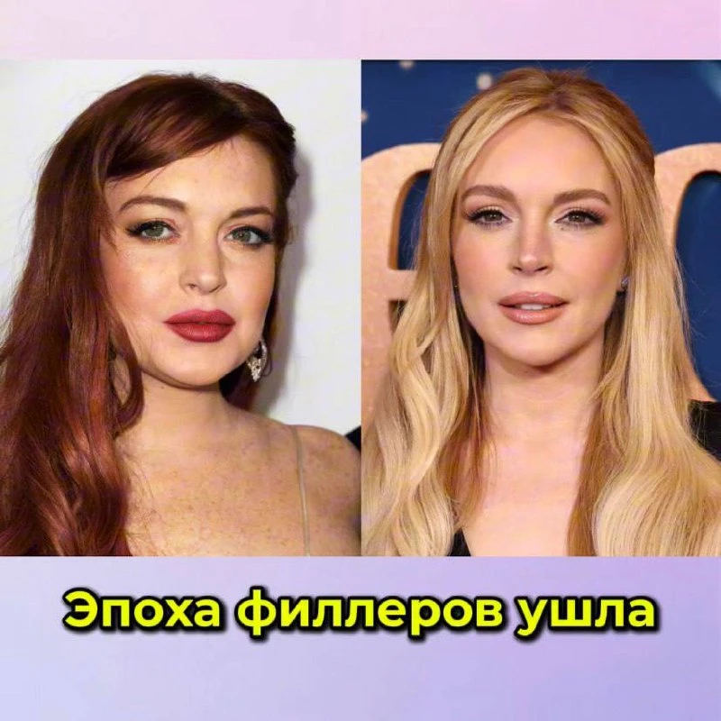 Эпоха филлеров ушла‼️ звезды от них отказываются

Вы тоже замечали👀 как за последние годы известные