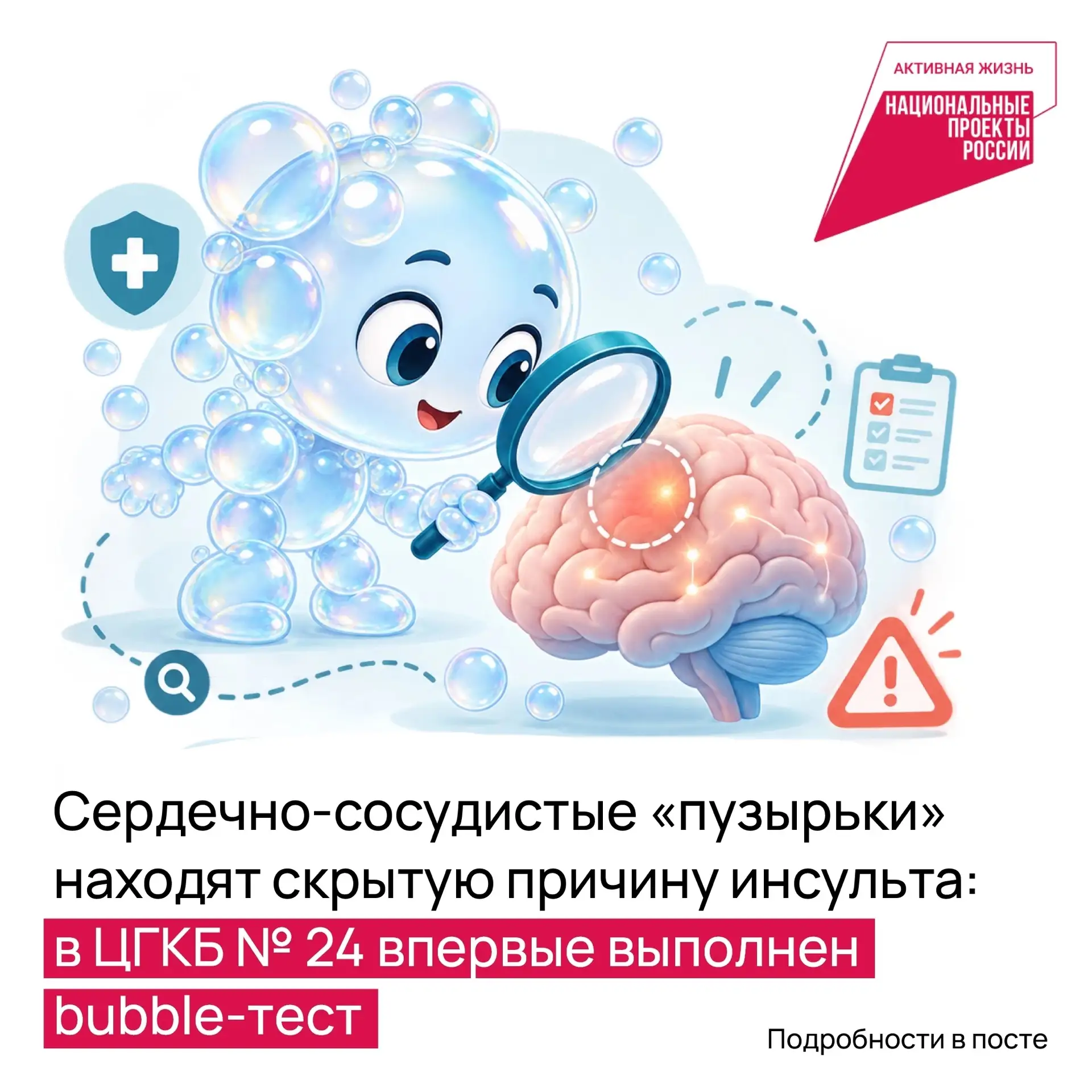 🫧 Операция «Мыльные пузыри»: как в ЦГКБ № 24 запустили детективов прямо в мозг!