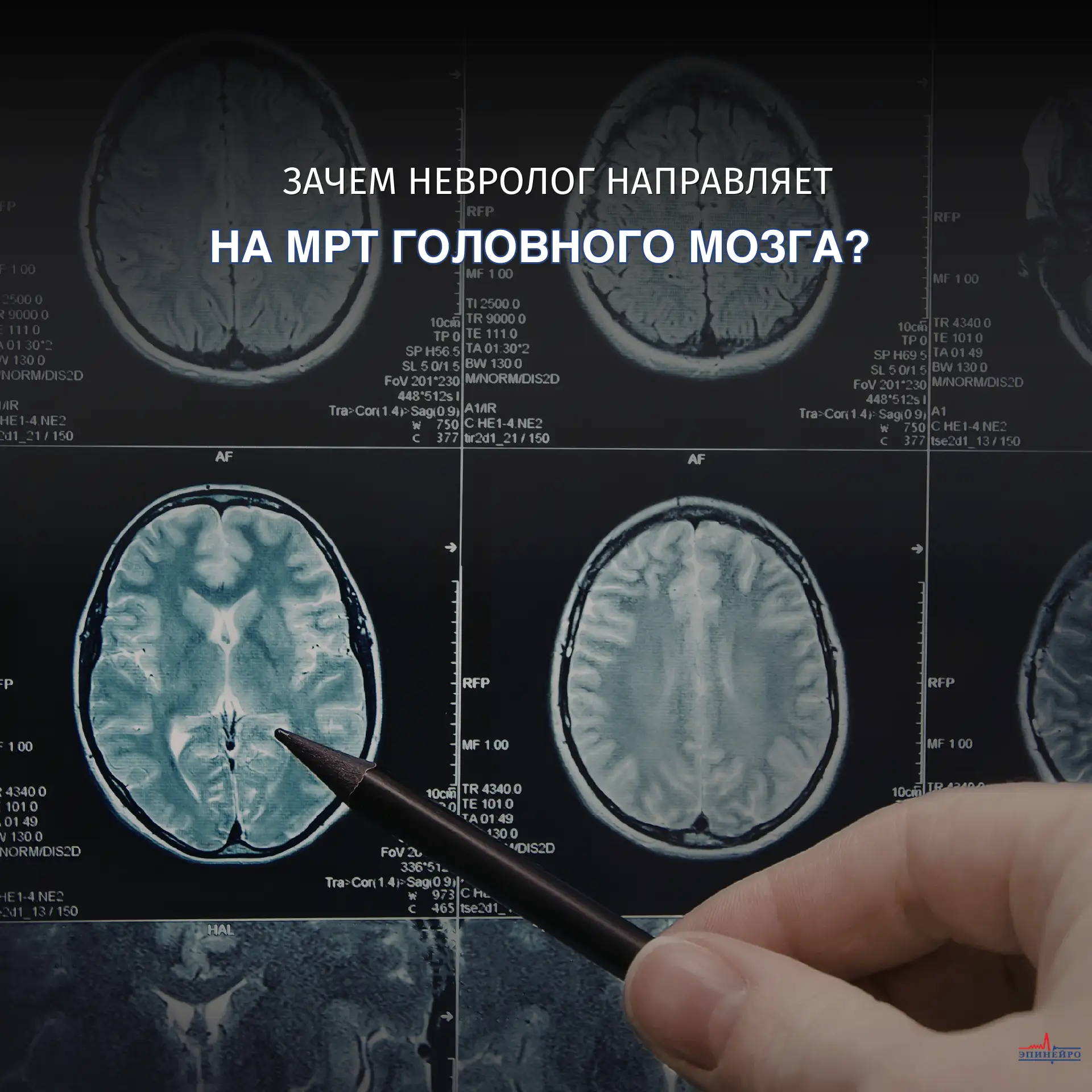 Зачем невролог направляет на МРТ головного мозга?

Магнитно-резонансная томография (МРТ) — это метод