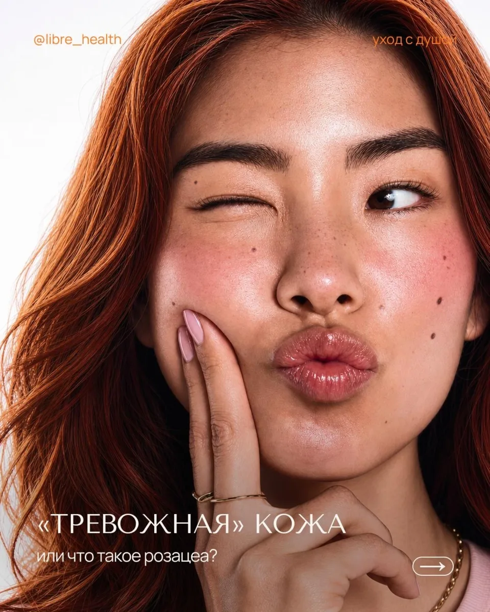 Щеки краснеют от стресса, а перед важным событием выскакивает прыщ — замечали такое?

Это не случа