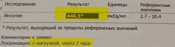 Инсулин мешает забеременеть при СПКЯ.