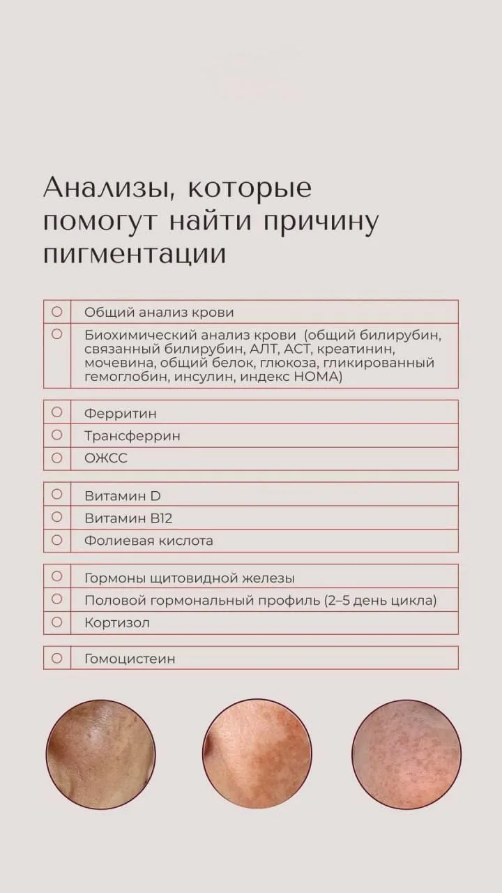 #пигмент
#пигментация