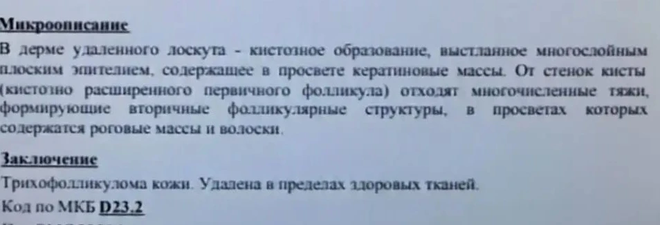 Случай номер три. Опухоль появилась и увеличилась по площади быстро. Иссекли под основа...