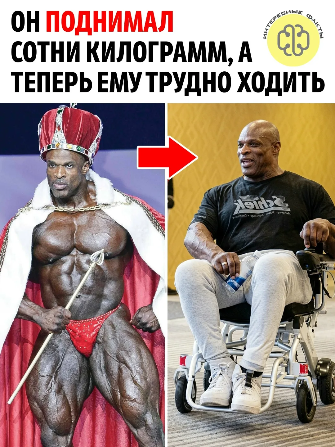 Ронни Коулман считается одним из величайших бодибилдеров в истории. С 1998 по 2005 год ...