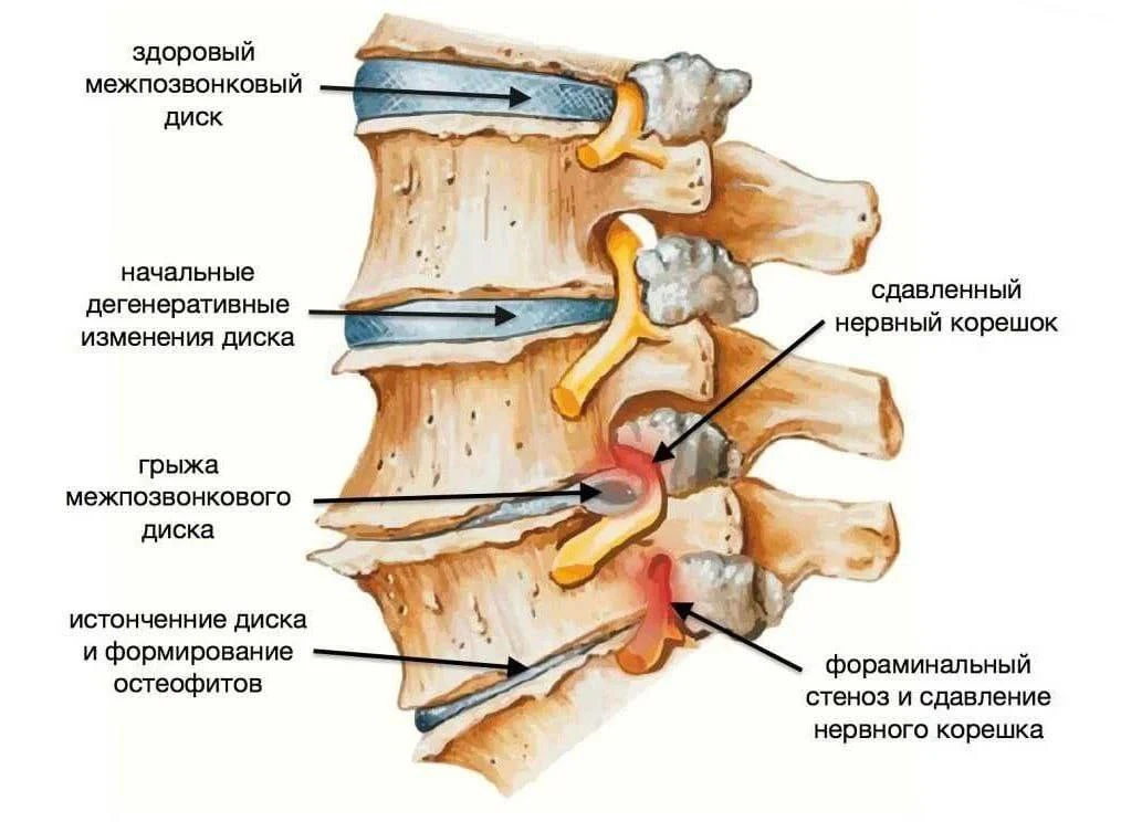 Боли в спине, шее и суставах стали нормой❓