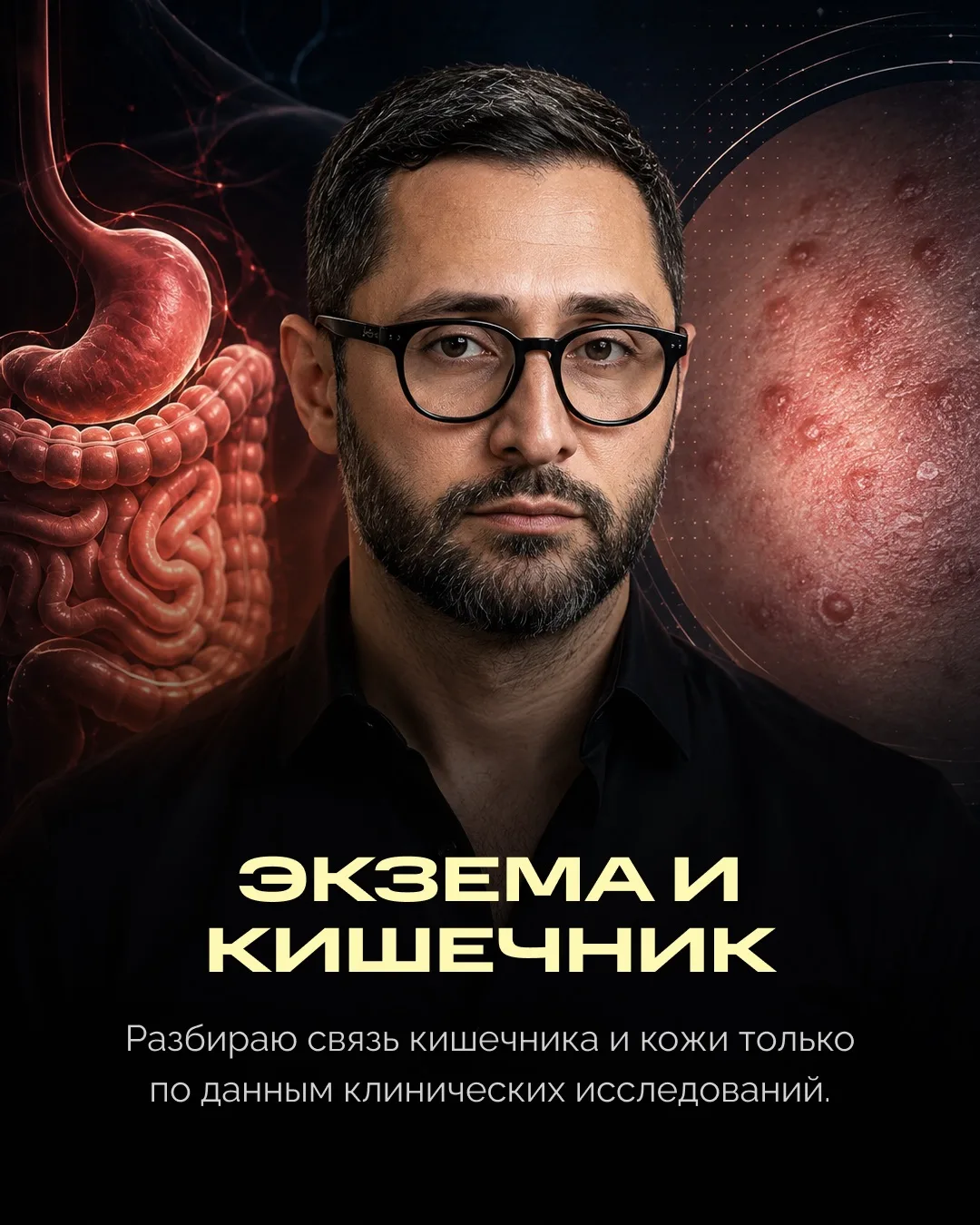 Экзема - это хроническое воспалительное заболевание, в основе которого барьерная дисфун...