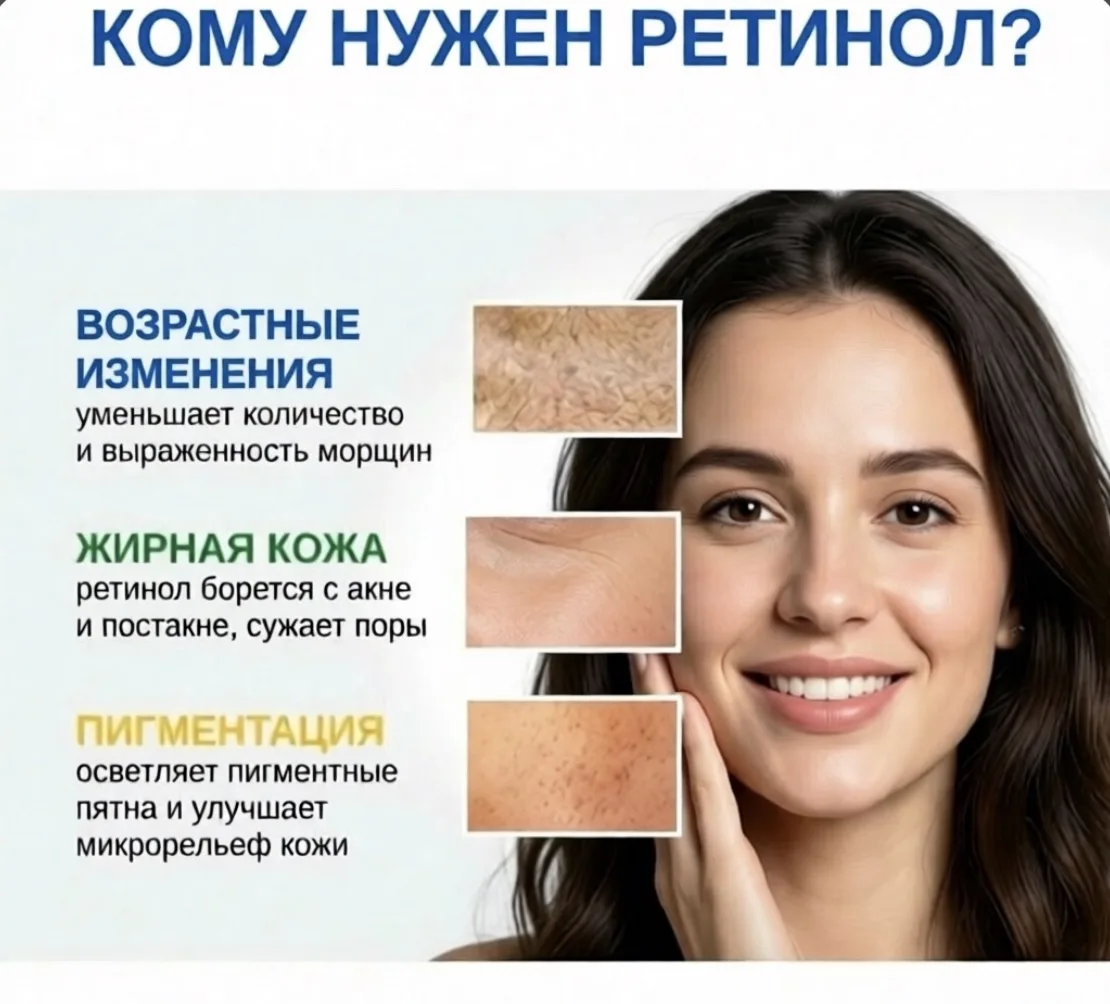Чтобы ввести ретинол в уход за кожей, следуйте этим правилам: