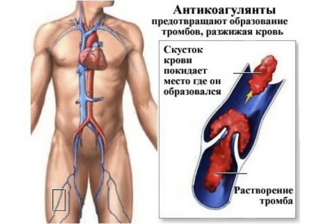 На самом деле тут есть важный нюанс: в быту говорят «разжижать кровь», но с медицинской точки зрения