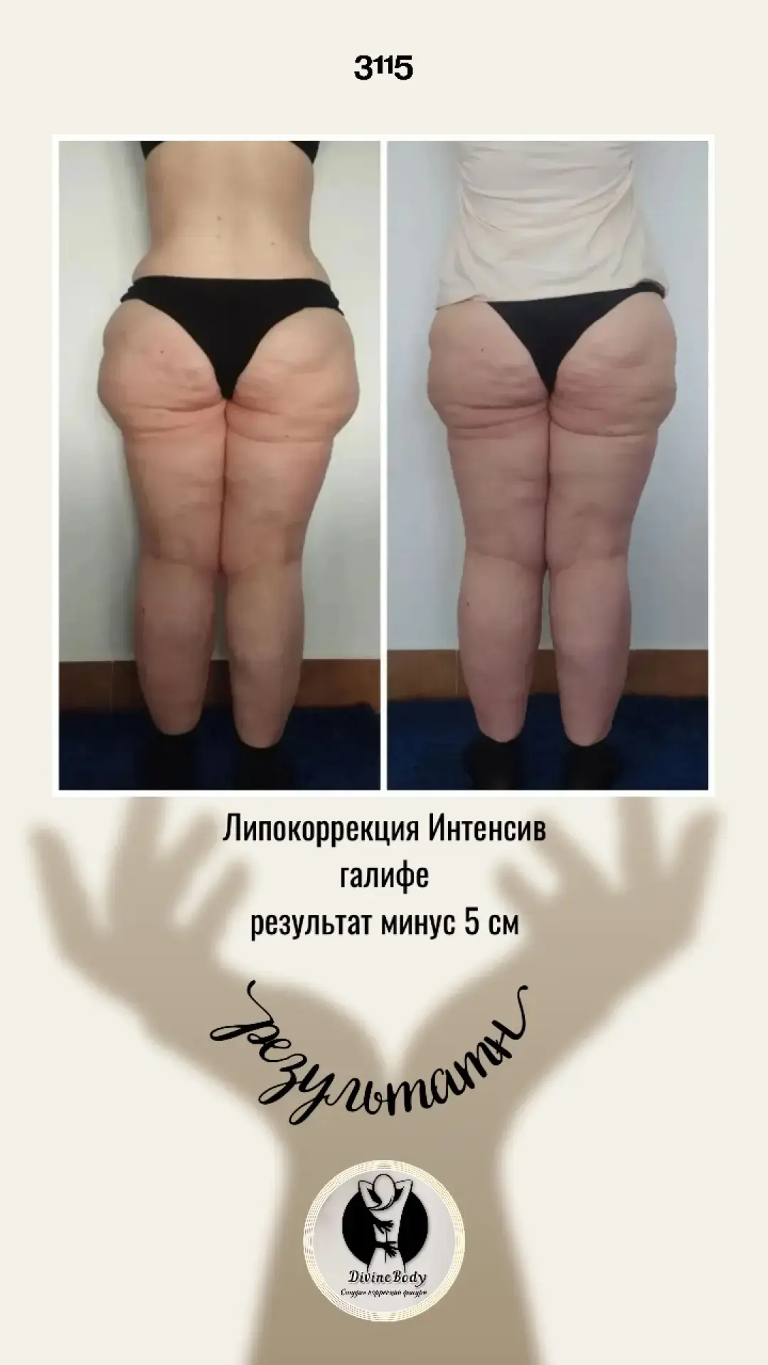 ✨ Минус 5 см в зоне галифе — и это только начало!