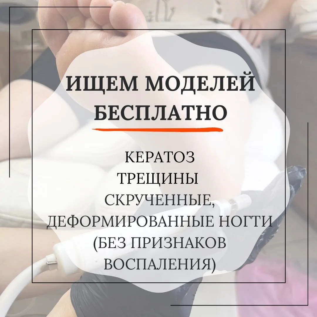 ‼️ ИЩЕМ МОДЕЛЕЙ С ТРЕЩИНАМИ, КЕРАТОЗОМ И ДЕФОРМИРОВАННЫМИ НОГТЯМИ НА БЕСПЛАТНУЮ ПОДОЛОГ...