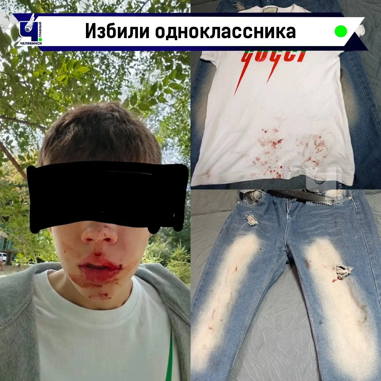 😰 В День знаний школьника из Магнитогорска избили одноклассники