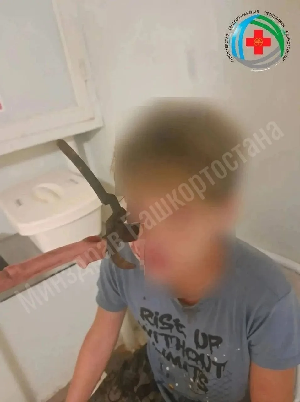 😱 Садовый секатор вонзился в щеку 14-летнего подростка из Башкирии и застрял в верхней челюсти.

По