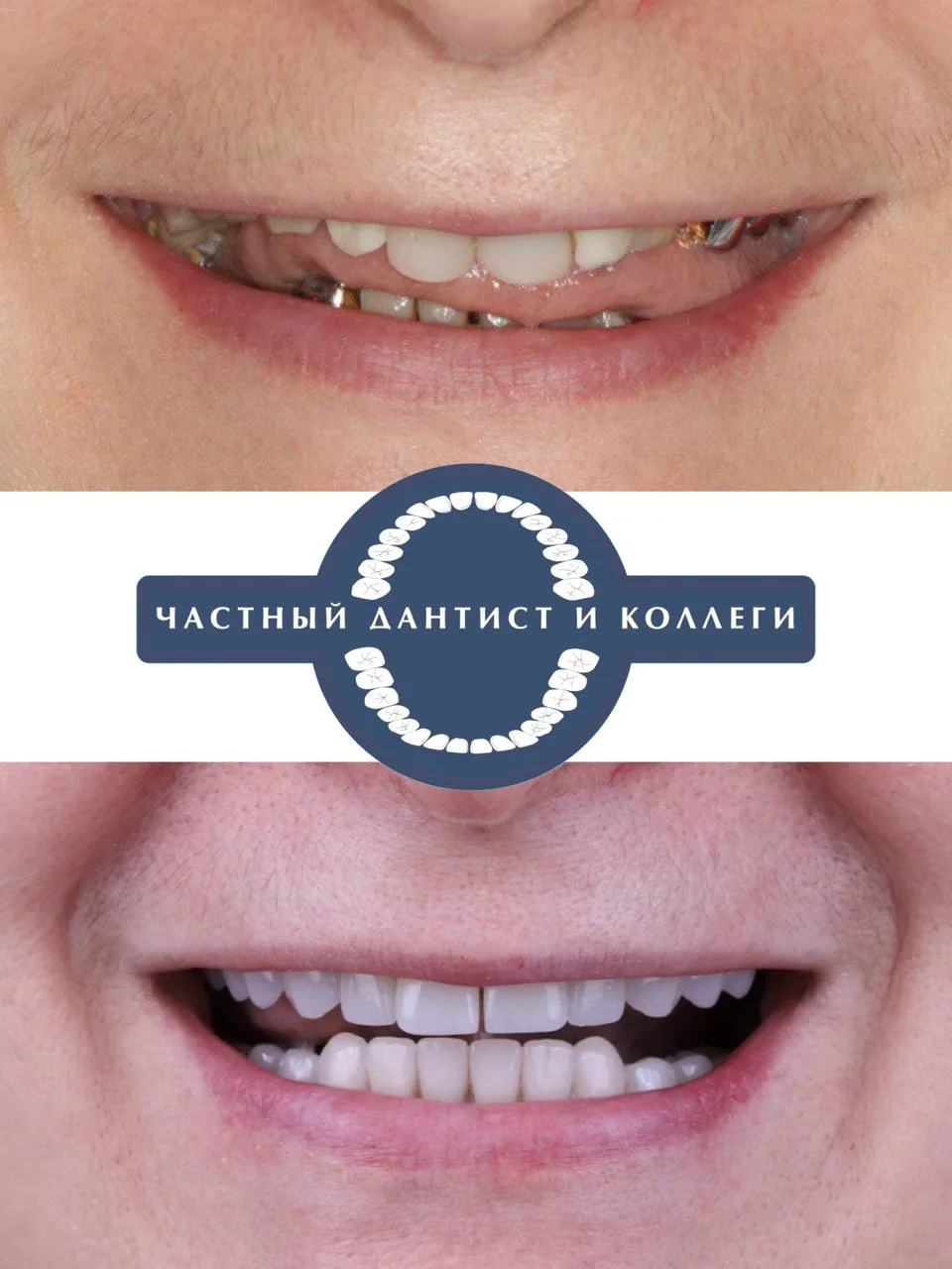 Друзья, мы подготовили для вас новую рубрику  #стоматологическийдетектив