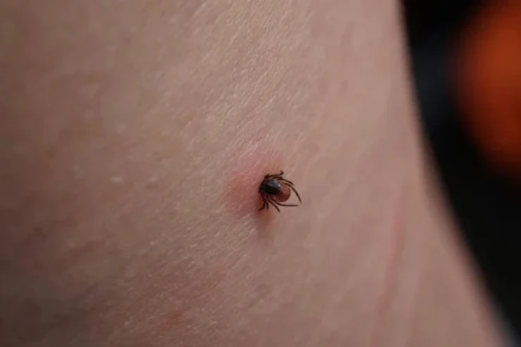 🕷 Второй пик активности иксодовых клещей в Москве и Московской области придется на август-сентябрь,