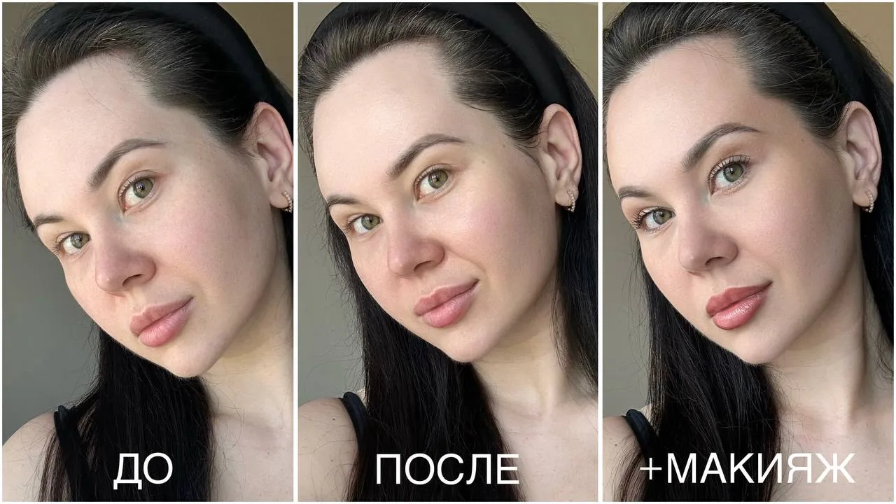 Хотите гладкое лицо без текстуры, как у дельфинчика? Тогда берите в руки этот тюбик.

Этот пилинг от