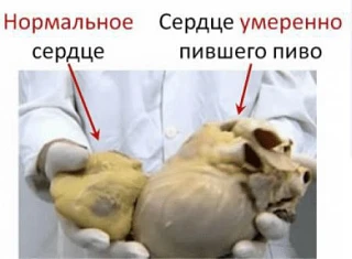 #МедЛикбез
