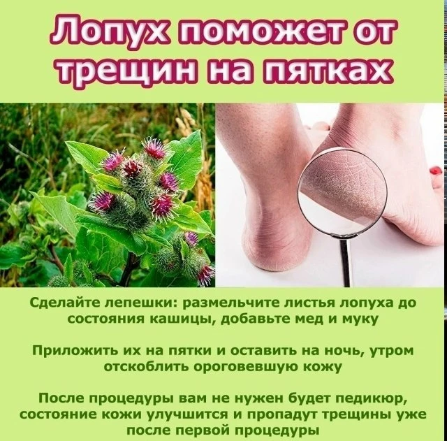 Лопух поможет от трещин на пятках

Клятва Гиппократа