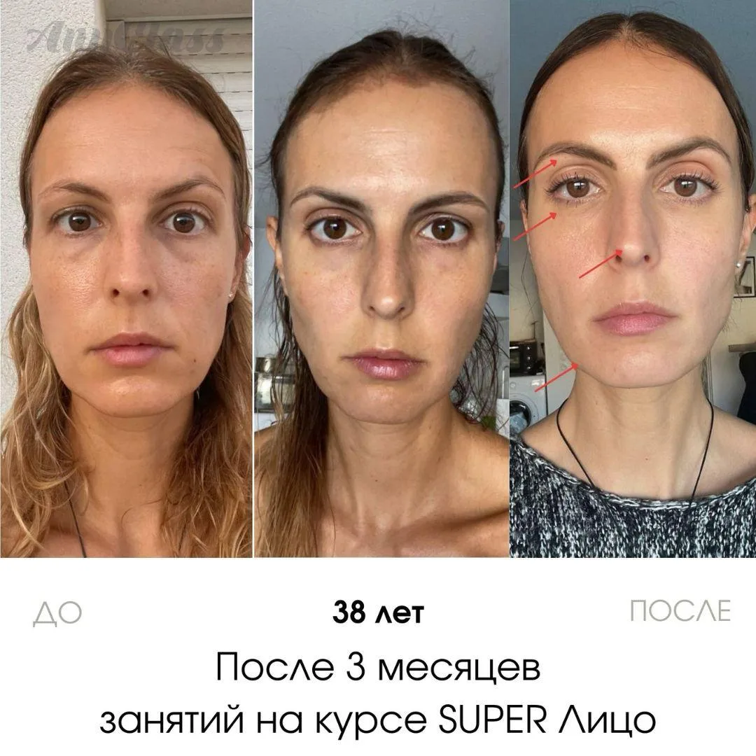 Из-за гимнастики появятся новые морщины👀  Это один из самых распространённых мифов о гимнастике, с к