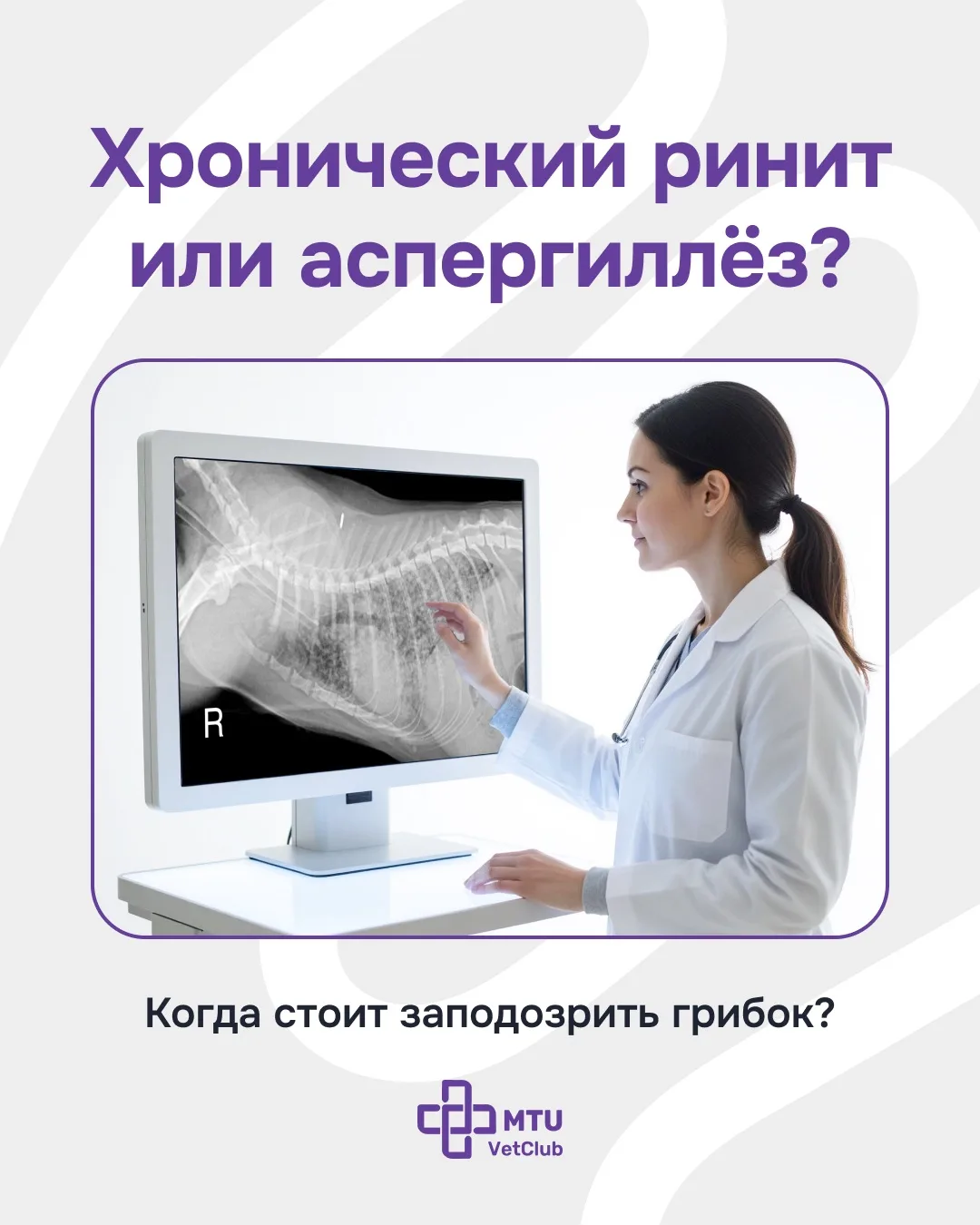 Аспергиллёз: про гриб, разрушающий кости
